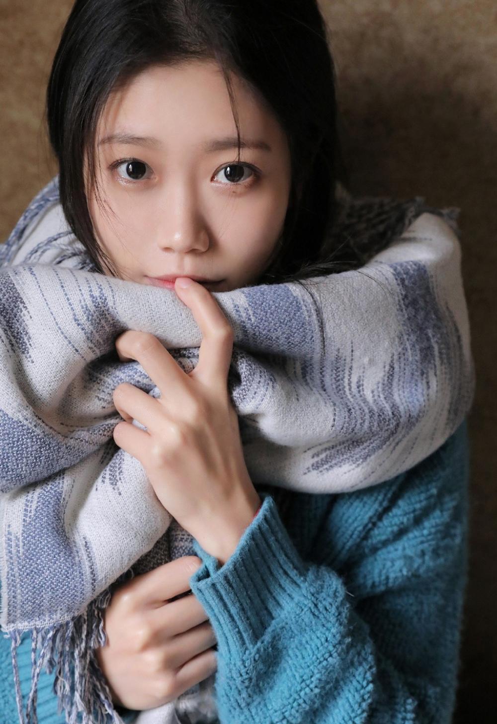 眼膏 红霉素眼膏的作用 你不知道的作用很多